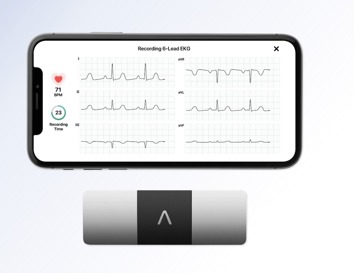 KardiaMobile 6L heart monitoring device